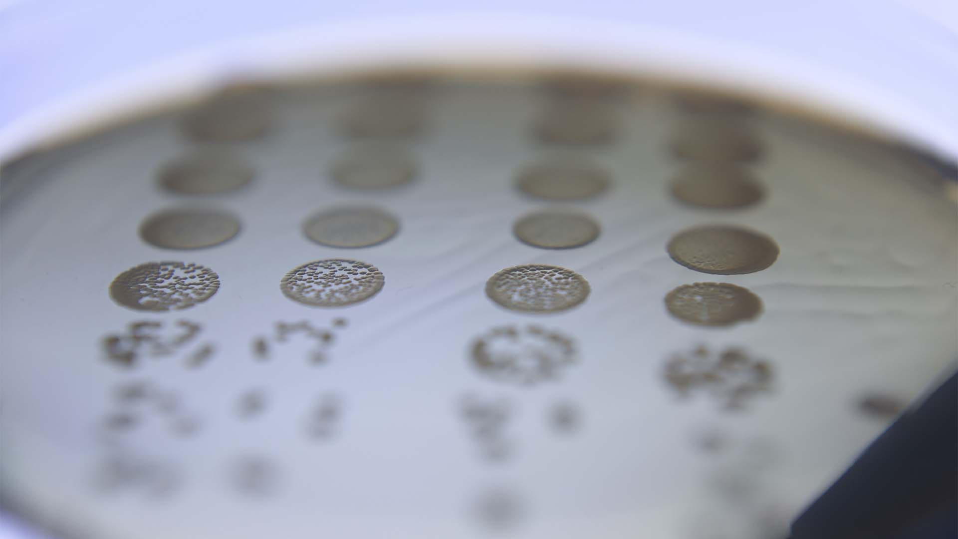 Sem antibiótico. Vírus são a aposta da PhageLab contra a salmonella