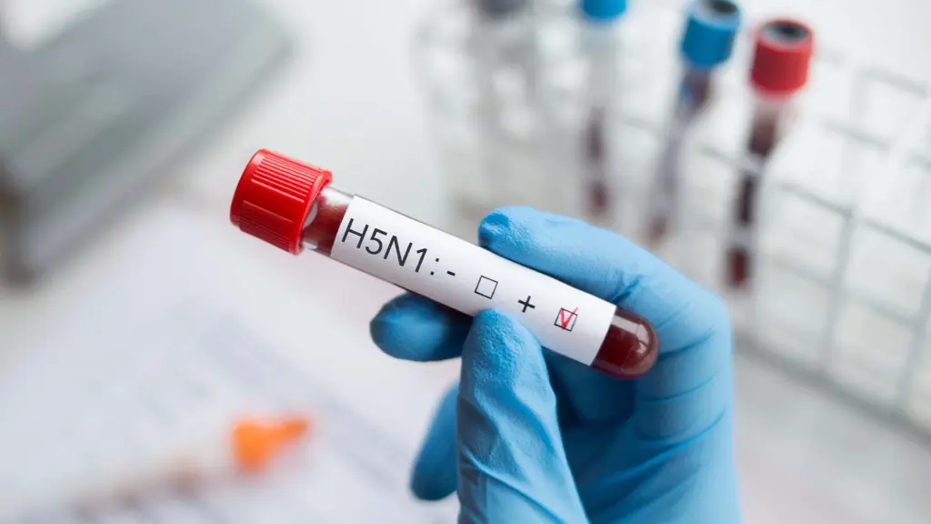 Teste gripe aviária