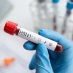 Teste gripe aviária